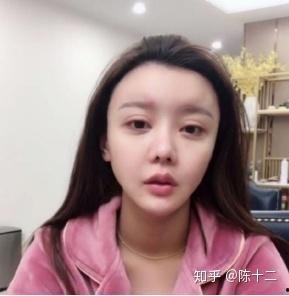 明星网红隆鼻都用什么,他们都用的同款材料？